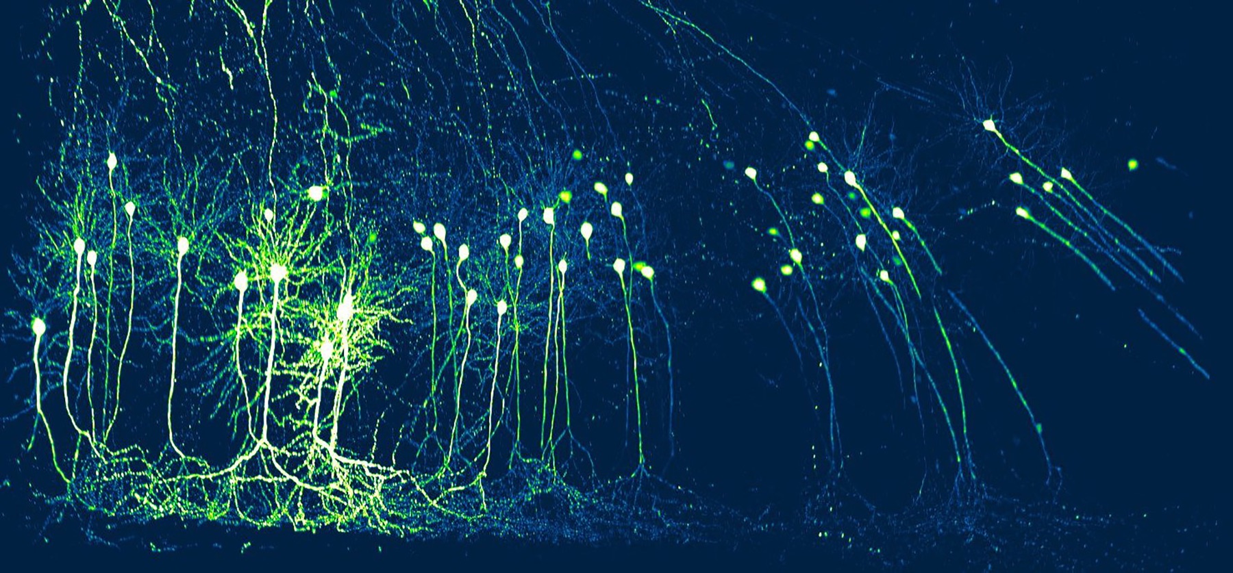 Forest Neuron