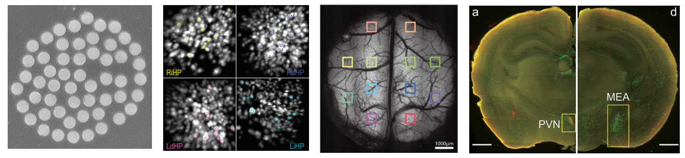 Neural Activity Recording